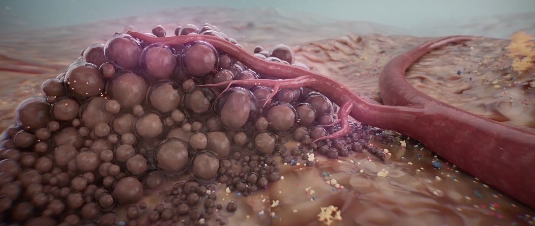 Tumor 3D medical animation
