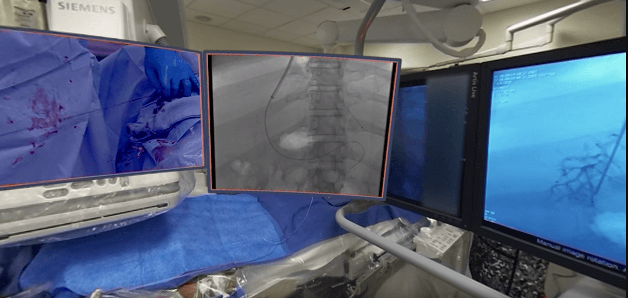 The first experience of VR in interventional radiology