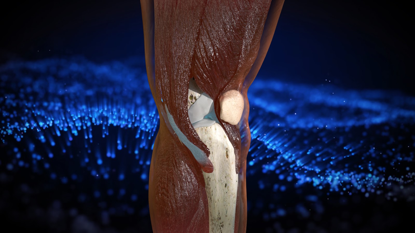 Knee Cartilage Regeneration
