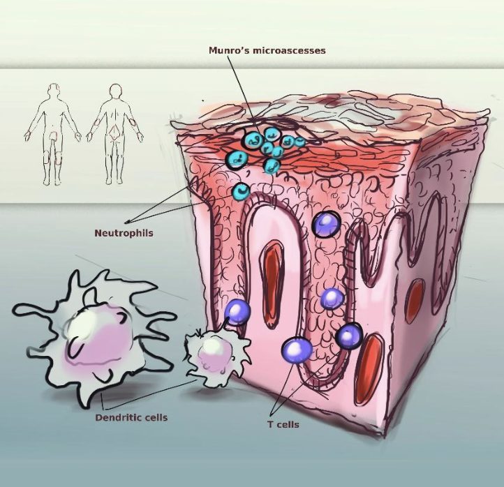 Gut-skin axis