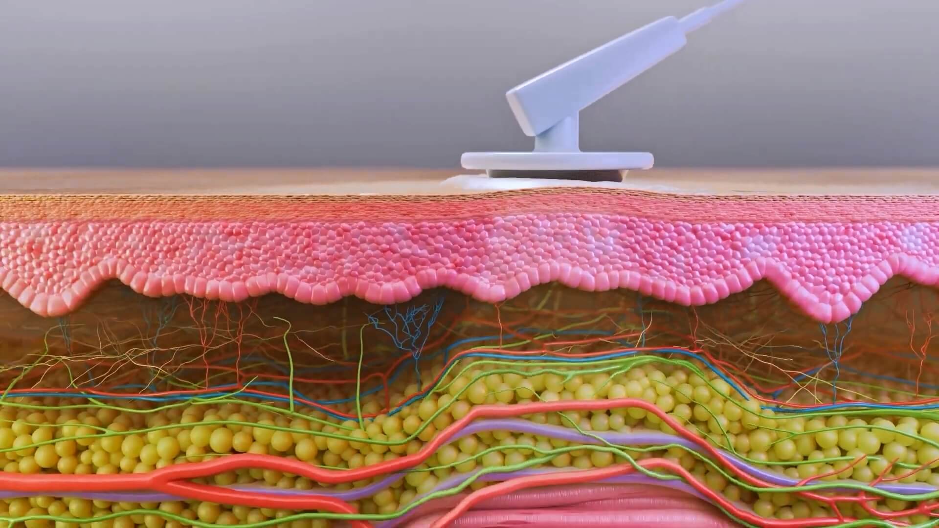 Medical animation can help dermatology