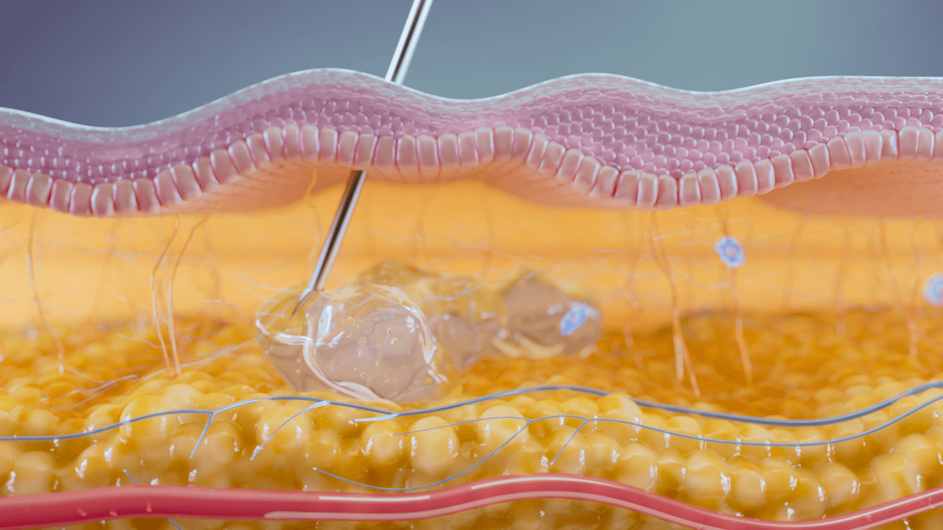 Why Aesthetic Businesses Should Use Medical Animation